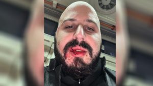 ორბორბლიანების მარშის ერთ-ერთ ორგანიზატორს თავს დაესხნენ – იხილეთ ფოტო