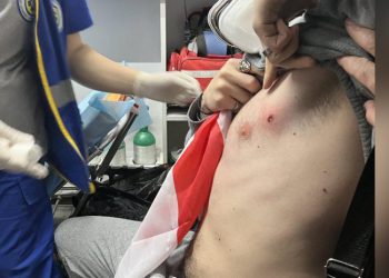 რუსთაველზე იყენებენ რეზინის ტყვიებსაც – არიან დაშავებულები