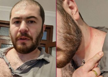 აქტივისტ ნიკო გაფრინდაშვილს თავს დაესხნენ