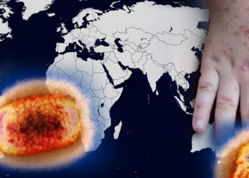 ჰანს კლუგე: “მაიმუნის ყვავილი” ახალი Covid 19 არ არის