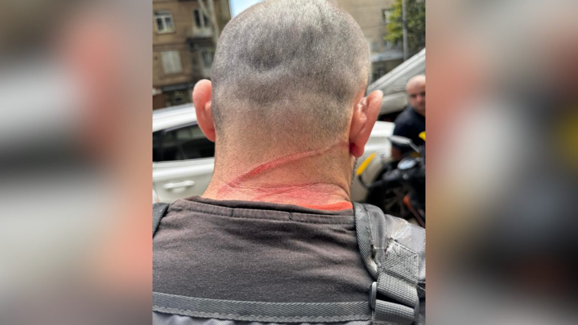 კურიერი, რომელიც გზაზე ჩამოკიდებულ მავთულს წამოედო და დაშავდა, პოლიციამ აქეთ დააჯარიმა — თვითმხილველი