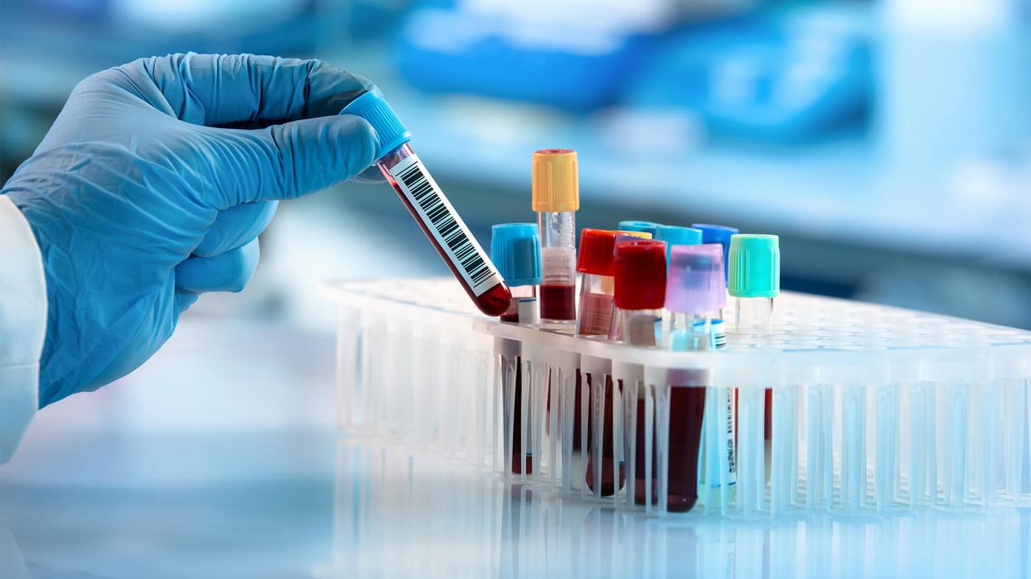 ნახეთ ანალიზების ჩამონათვალი, რომელიც ყველა 45 წელს გადაცილებულმა ადამიანმა უნდა გაიკეთოს