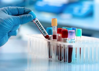 ნახეთ ანალიზების ჩამონათვალი, რომელიც ყველა 45 წელს გადაცილებულმა ადამიანმა უნდა გაიკეთოს