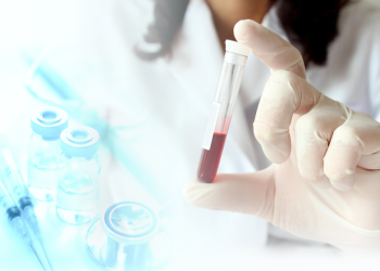 სისხლის საერთო ანალიზის რომელი პარამეტრია განსაკუთრებით საყურადღებო – ექიმის განმარტება