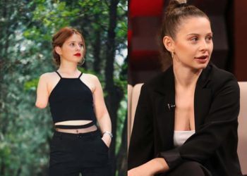 “არავინ მეუბნებოდა, რომ ხელი არ მქონდა, ეშინოდათ თავისთვის რამე არ დამეშავებინა”- ლიკუნა ჩაჩიბაია წლების წინ მომხდარ შემთხვევას იხსენებს