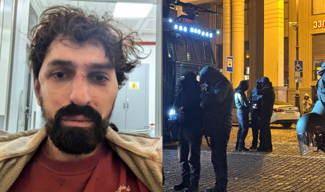 “მითხრეს, ჟურნალისტი რომ ხარ მაგიტომ (გცემთ). მაგინებდნენ და დამიწყეს ცემა გამეტებით” – რას ამბობს “პუბლიკას” ჟურნალისტი, ალექსანდრე ქეშელაშვილი სამართალდამცველებზე