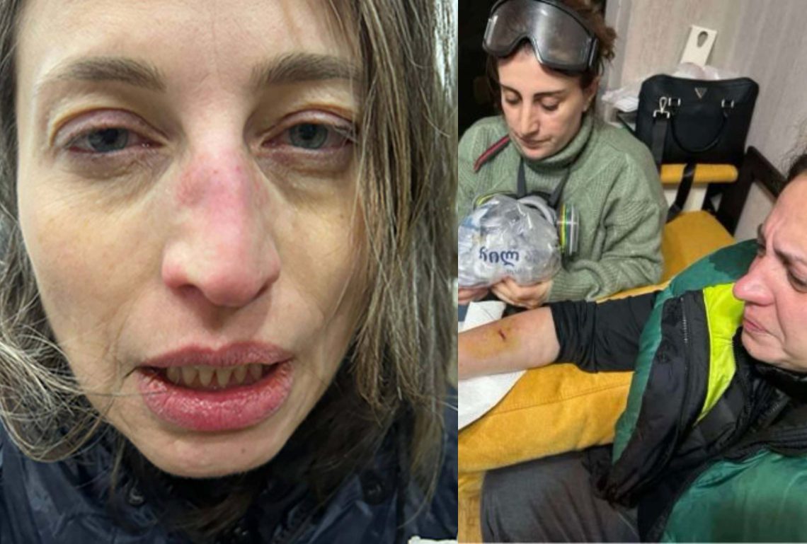 ელენე ხოშტარიასა და ნანა მალაშხიას აქციაზე ფიზიკურად გაუსწორდნენ