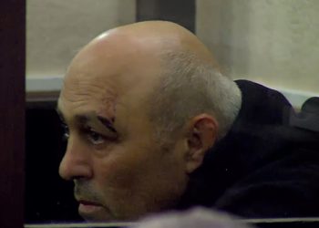 “ძირს დამახეთქეს, სისხლი მდიოდა” – პოლიციელების მიერ ნაცემი ანატოლი გიგაური პატიმრობაში დატოვეს