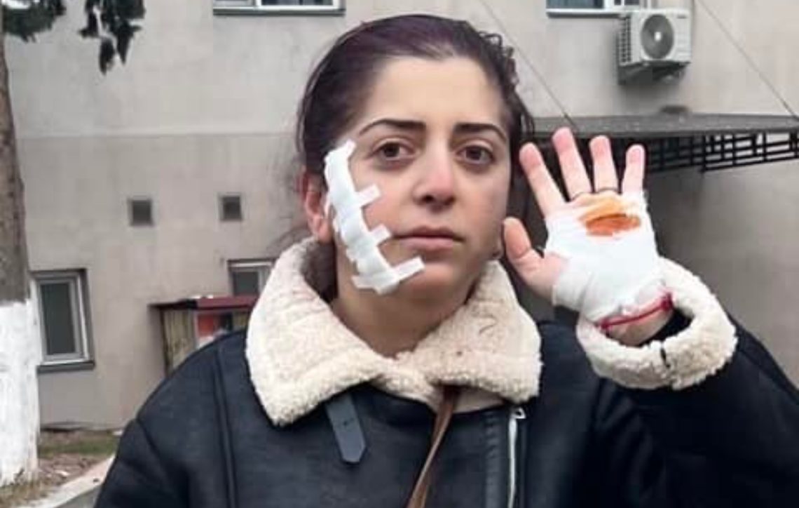 რას წერს სკოლის მასწავლებელი, რომელსაც სამართებლით თავს დაესხნენ