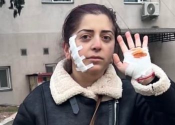 რას წერს სკოლის მასწავლებელი, რომელსაც სამართებლით თავს დაესხნენ