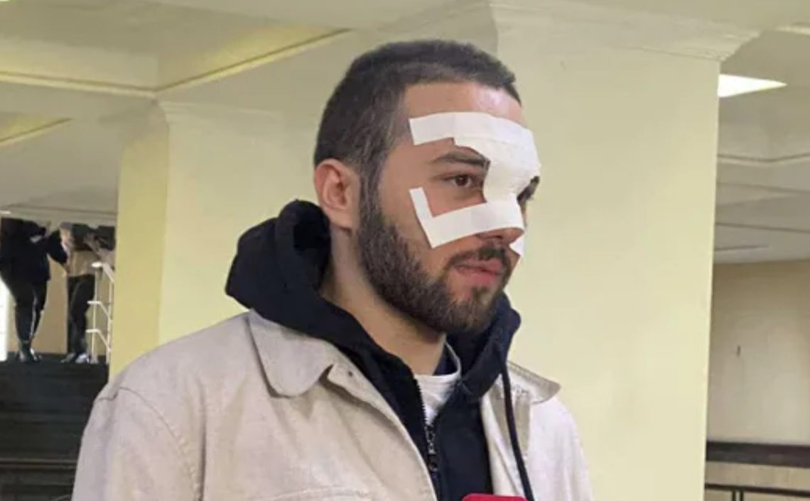 “ტელეკამერებს რომ გავცდით, დაიწყო ჩემი წამება…მეგონა ვეღარ გადავრჩებოდი” – რას ჰყვება აქციაზე დაკავებული დავით გოგილაშვილი