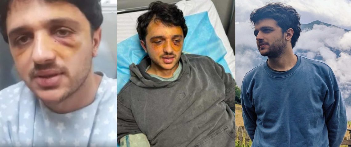 🎥 “გვაიძულებდნენ, რომ გვეთქვა, “ხარებას გაუმარჯოს!” – რას ჰყვება სპეცრაზმელების მიერ სასტიკად ნაცემი დათა ხარაიშვილი?