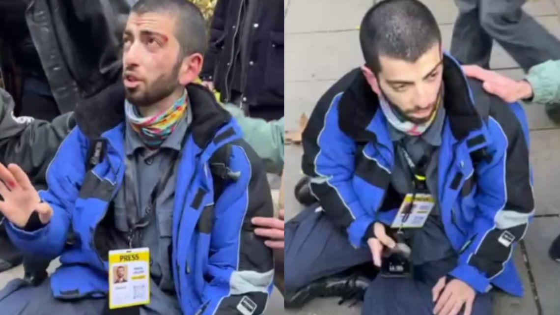 “პოლიციელების უმოქმედობა აჩენს ეჭვს, რომ სამართალდამცავი ორგანოები და ე.წ ტიტუშკები ერთად მოქმედებენ – საია “პუბლიკას” ჟურნალისტზე თავდასხმაზე