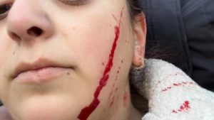 “გაა**ი შენ საყვარელ ევროპაში..." - დაბა კაზრეთში საჯარო სკოლის თანამშრომელს ჭრილობა მიაყენეს