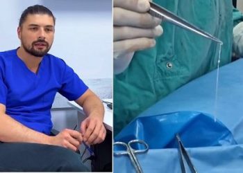 ვის არის ქართველი ექიმი, რომელმაც პაციენტს თავის ტვინიდან 15 სმ-იანი ცოცხალი ჭია ამოუღო. – ნახეთ წარმოუდგენელი კადრები