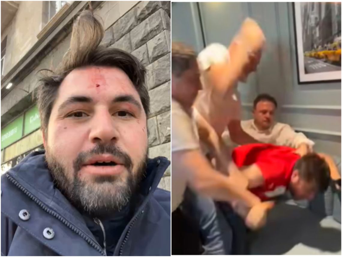 🎥„თავს დამესხა სამი ნიღბიანი“ – რას ჰყვება მოქალაქე, რომელსაც აბუ-დაბიში „ოცნების“ დეპუტატები თავს დაესხნენ