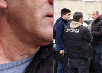 დაპირისპირება “მაგთიკომში” – პროფკავშირების ცნობით, ადმინისტრაციის უფროსი კომპანიის მძღოლს ფიზიკურად გაუსწორდა