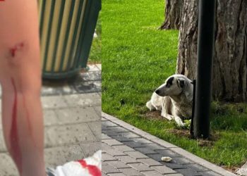 “არავინ გამოხტეს ახლა ძაღლების უფლებადამცველი, 10 წლის ბიჭს სამმა ძაღლმა ხორცები გამოაგლიჯა”- რას წერს მოქალაქე