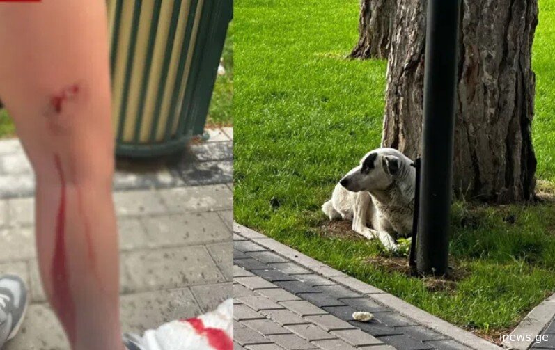 “არავინ გამოხტეს ახლა ძაღლების უფლებადამცველი, 10 წლის ბიჭს სამმა ძაღლმა ხორცები გამოაგლიჯა”- რას წერს მოქალაქე