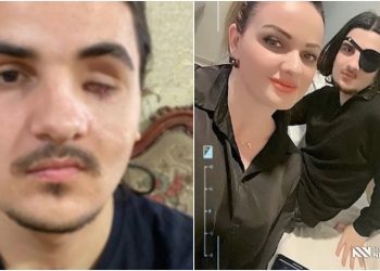 “უმძიმესი ავარიის შედეგად თვალი დაკარგა”- 17 წლის იაკობს დახმარება ესაჭიროება