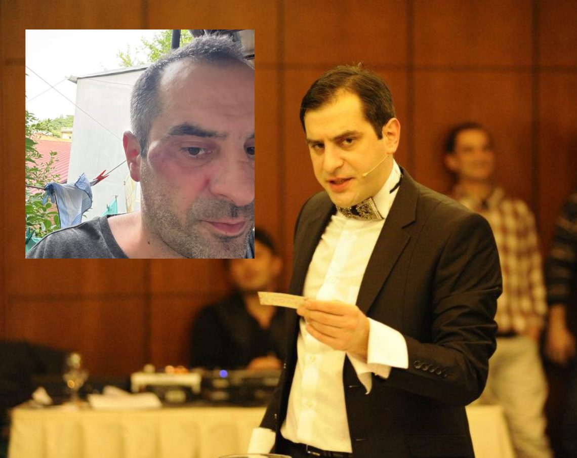 “ეს “დაქირავებულები” მეც დამხვდნენ სახლთან” – ვანო თარხნიშვილს თავს დაესხნენ