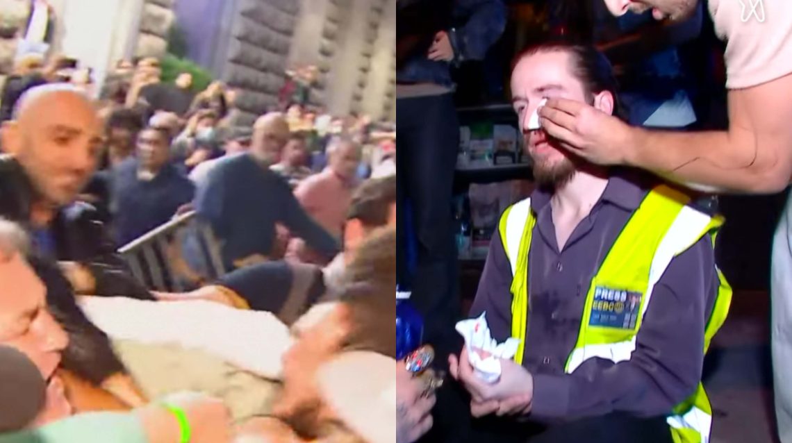 მელიქიშვილის გამზირზე გამართულ აქციაზე ფიზიკურად უნგრელი ჟურნალისტი დაშავდა