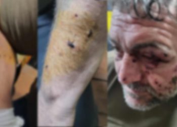 უკრაინაში, საბრძოლო დავალების დროს ორი ქართველი მებრძოლი დაიჭრა