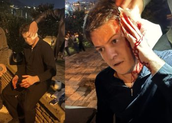 “გვერდიდან მომეპარა”- რას ამბობს იგორ ნარმანია, რომელსაც ცოტა ხნის წინ თავს დაესხნენ