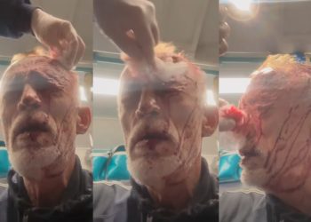 ნადიმ ხმალაძე საავადმყოფოში გადაიყვანეს – როგორია მისი მდგომარეობა