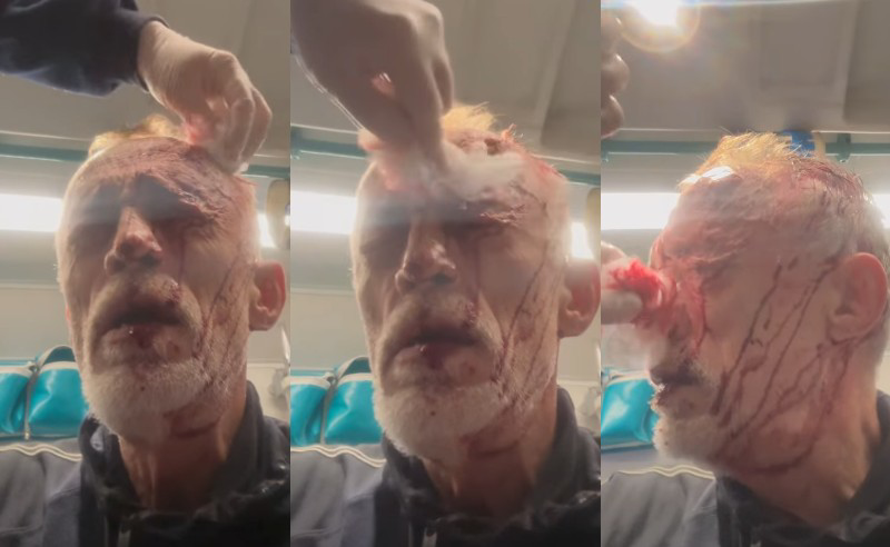 ნადიმ ხმალაძე საავადმყოფოში გადაიყვანეს – როგორია მისი მდგომარეობა