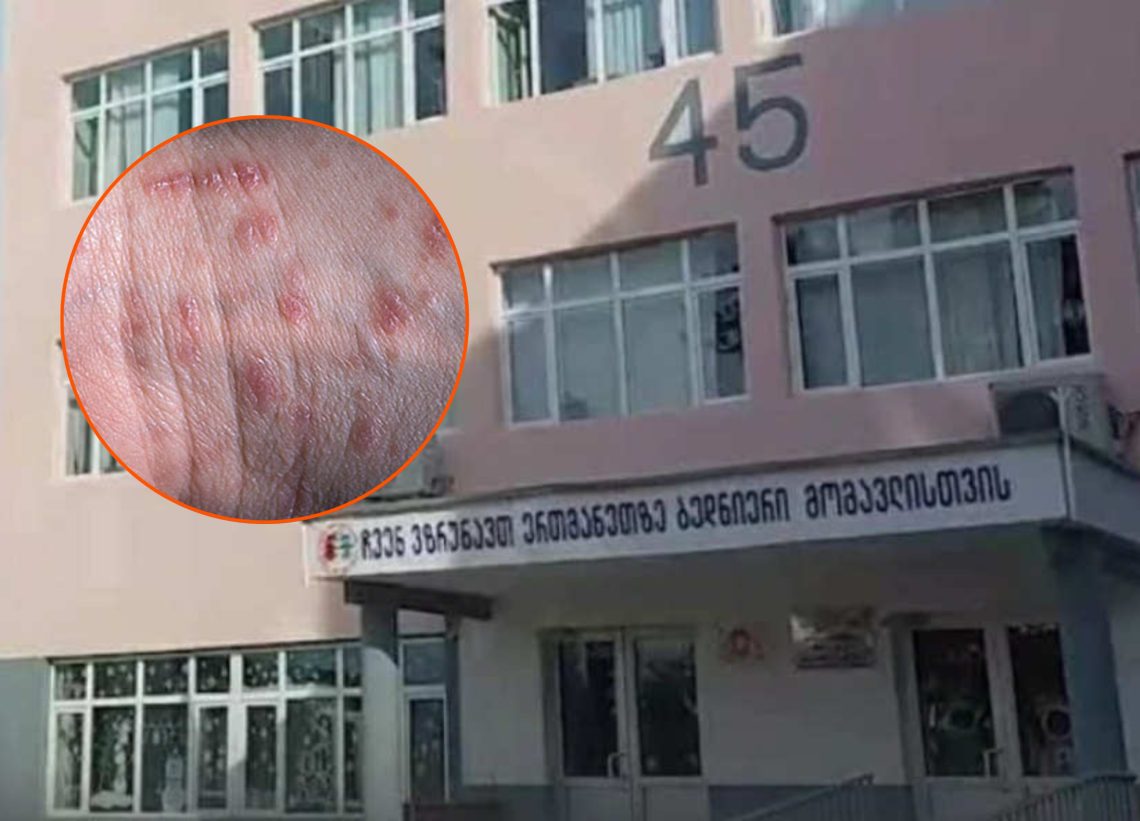 სკოლა რომელშიც მუნის შემთხვევები დაფიქსირდა, მომხდარს ეხმაურება