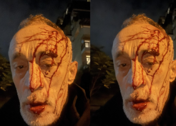 ნადიმ ხმალაძეს თავს დაესხნენ