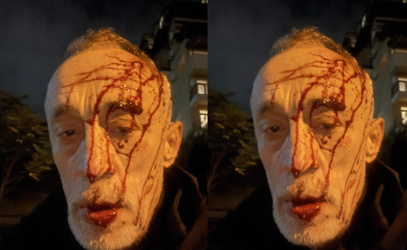 ნადიმ ხმალაძეს თავს დაესხნენ