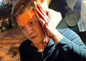 ევროპის მოედანთან აქტივისტებს ფიზიკურად გაუსწორდნენ – დაშავებულია ენმ-ის წევრი, იგორ ნარმანიაც