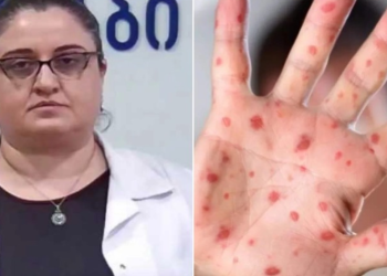 ინფექციონისტი მაია ბუწაშვილი მუნთან დაკავშირებით მოსახლეობას აფრთხილებს