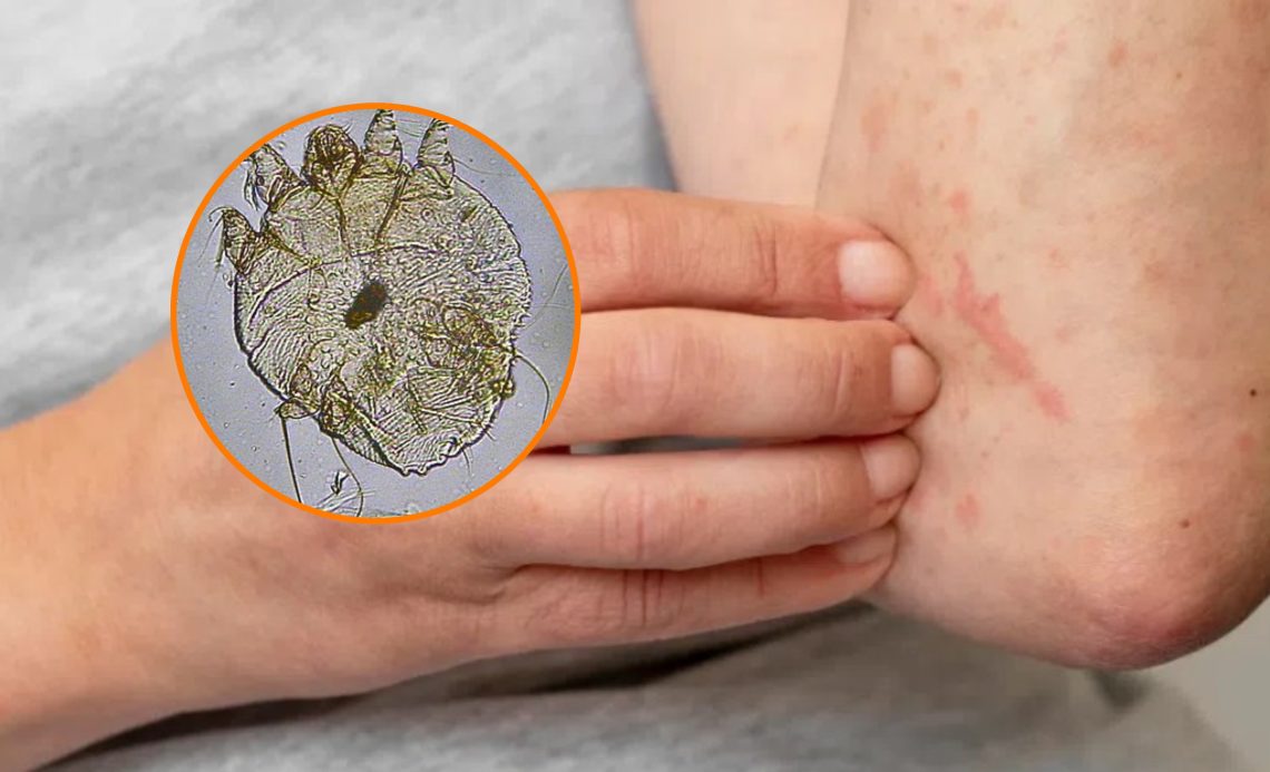 ქუთაისის საჯარო სკოლებში მუნის შემთხვევები დაფიქსირდა