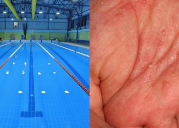 როგორია მუნის გადადების რისკი აუზიდან – ინფექციონისტის განმარტება