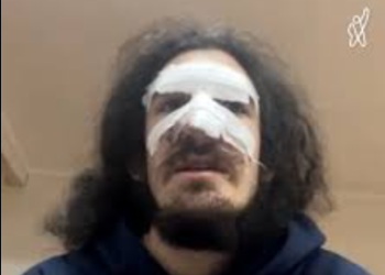 BBC-ის სიუჟეტის ერთ-ერთი რესპოდენტი, რომელსაც აქციაზე პოლიცია გაუსწორდა, გამოკითხვაზე დაიბარეს