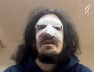 BBC-ის სიუჟეტის ერთ-ერთი რესპოდენტი, რომელსაც აქციაზე პოლიცია გაუსწორდა, გამოკითხვაზე დაიბარეს