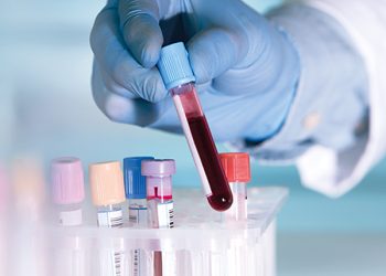 მეცნიერებმა ადამიანის სისხლის ახალი ჯგუფი აღმოაჩინეს