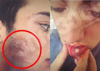 “პირდაპირ ჩემ სისხლში მედო სახე” – გორში დაკავებული ახალგაზრდის ჩვენება პოლიციის წინააღმდეგ