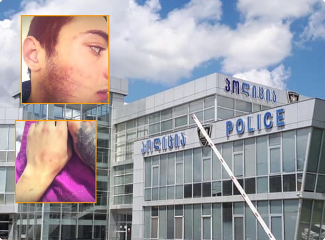 “გორში 20 წლის ახალგაზრდა 15-მდე პოლიციელს ფიზიკურ ძალადობაში ადანაშაულებს” – Tv პირველი