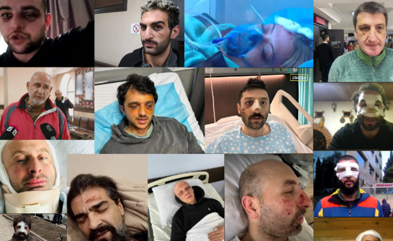 ასეულობით ნაცემი და ნაწამები მოქალაქე და არც ერთი დასჯილი მოძალადე – რა მოხვდა ომბუდსმენის ანგარიშში