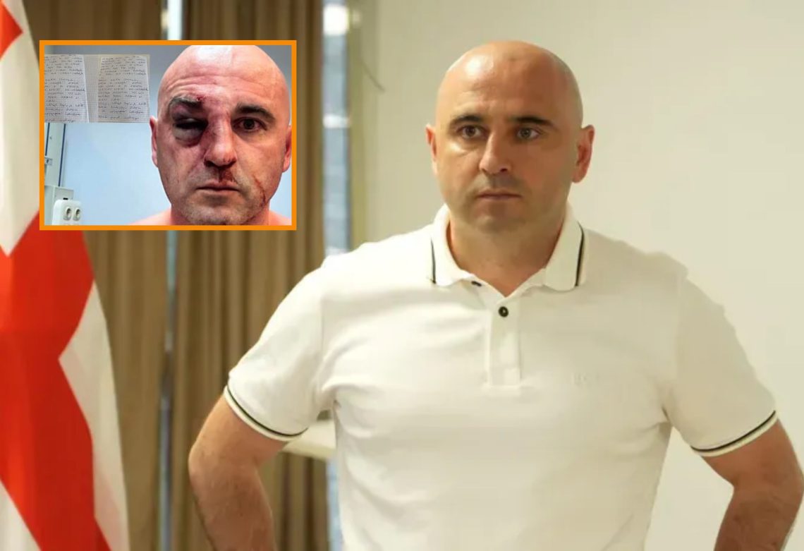 “ამ წამებას ჰყავდა ერთი მთავარი ორგანიზატორი…” – რას ამბობს ლევან ხაბეიშვილი